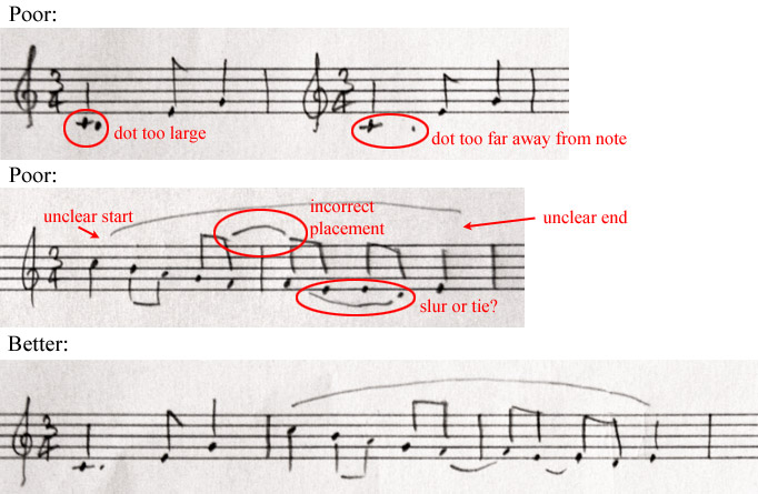 Poor and better dots and ties / slurs